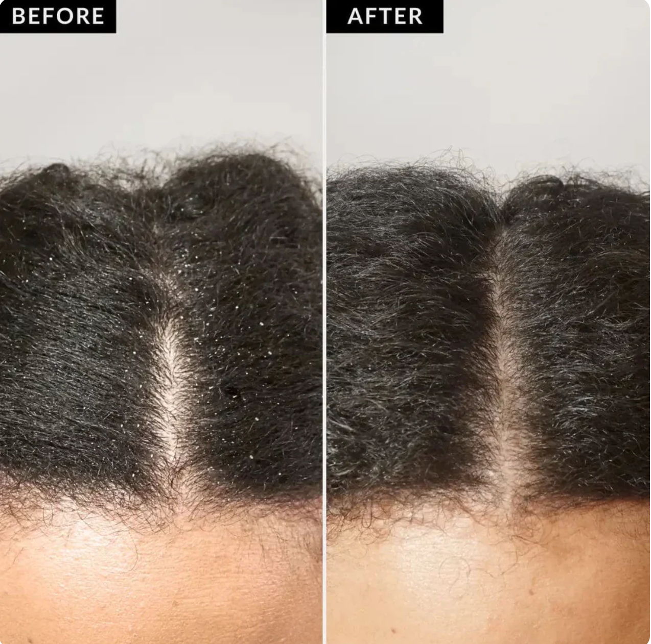Vetra Scalp Detox Comb